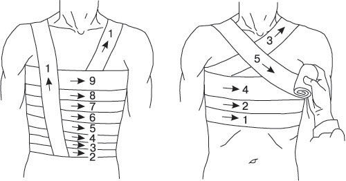 Наложение повязки на грудь: