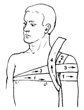 Наложение повязки на плечевой сустав