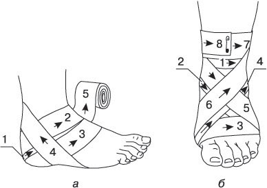 Повязки на область пятки (а) и на голеностопный сустав (б)